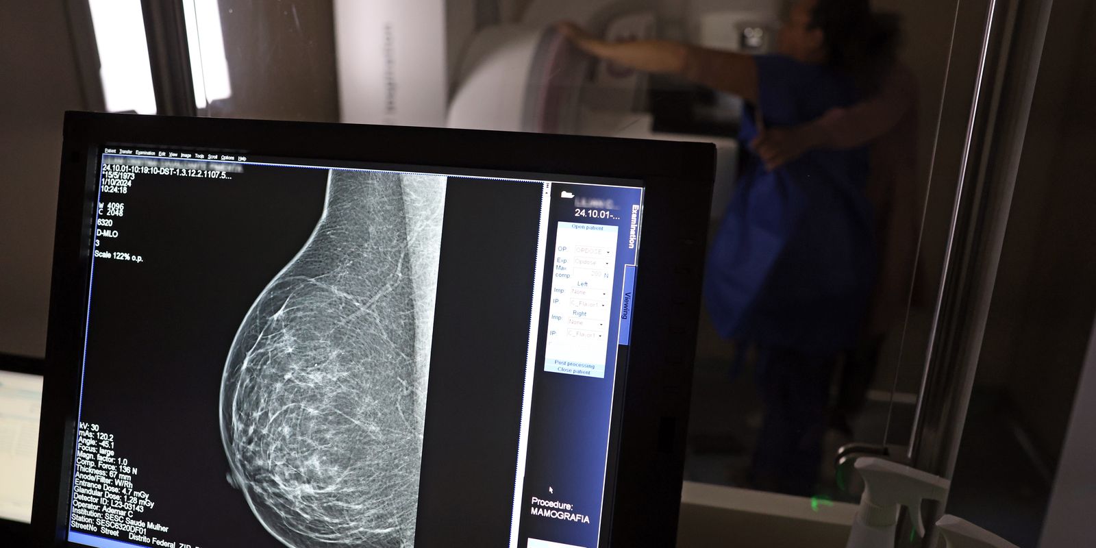 Câncer de mama: uma em cada três pacientes tem menos de 50 anos